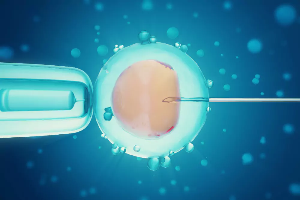 ICSI (Intracytoplasmic Sperm Injection)